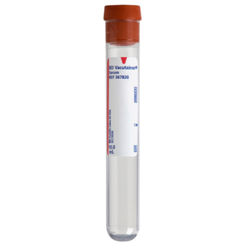 Pathology Serum Tube (Red)