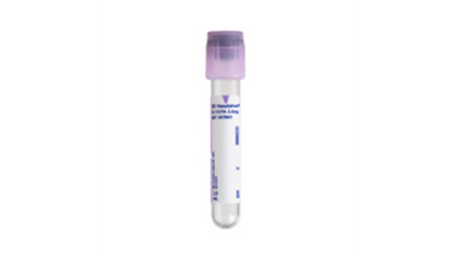 Pathology K₂EDTA Tube (Purple)